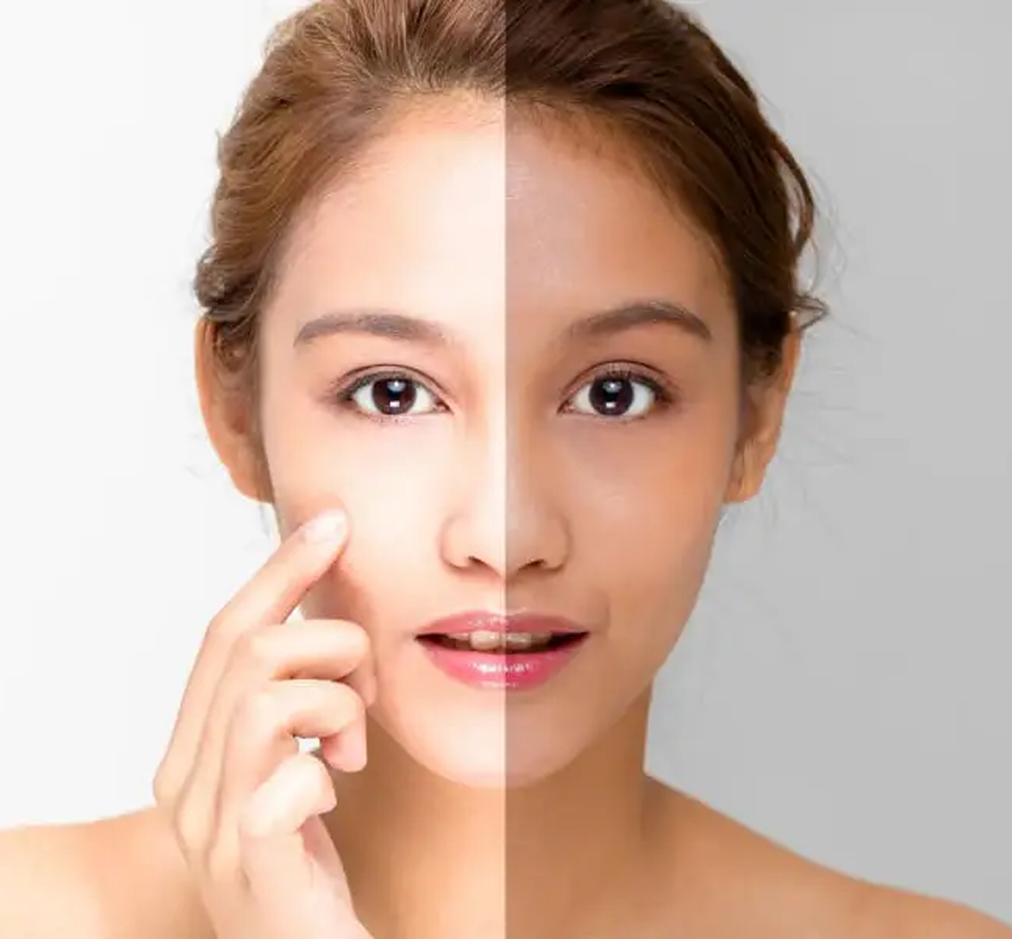 Skin Whitening Treatment