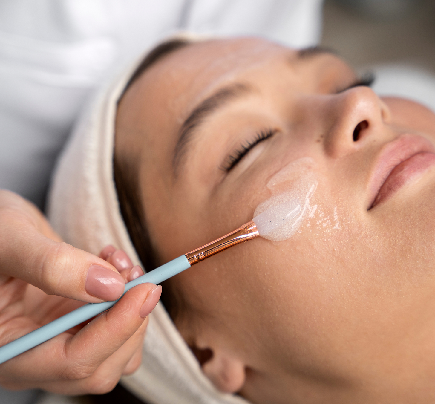 Chemical Peels
