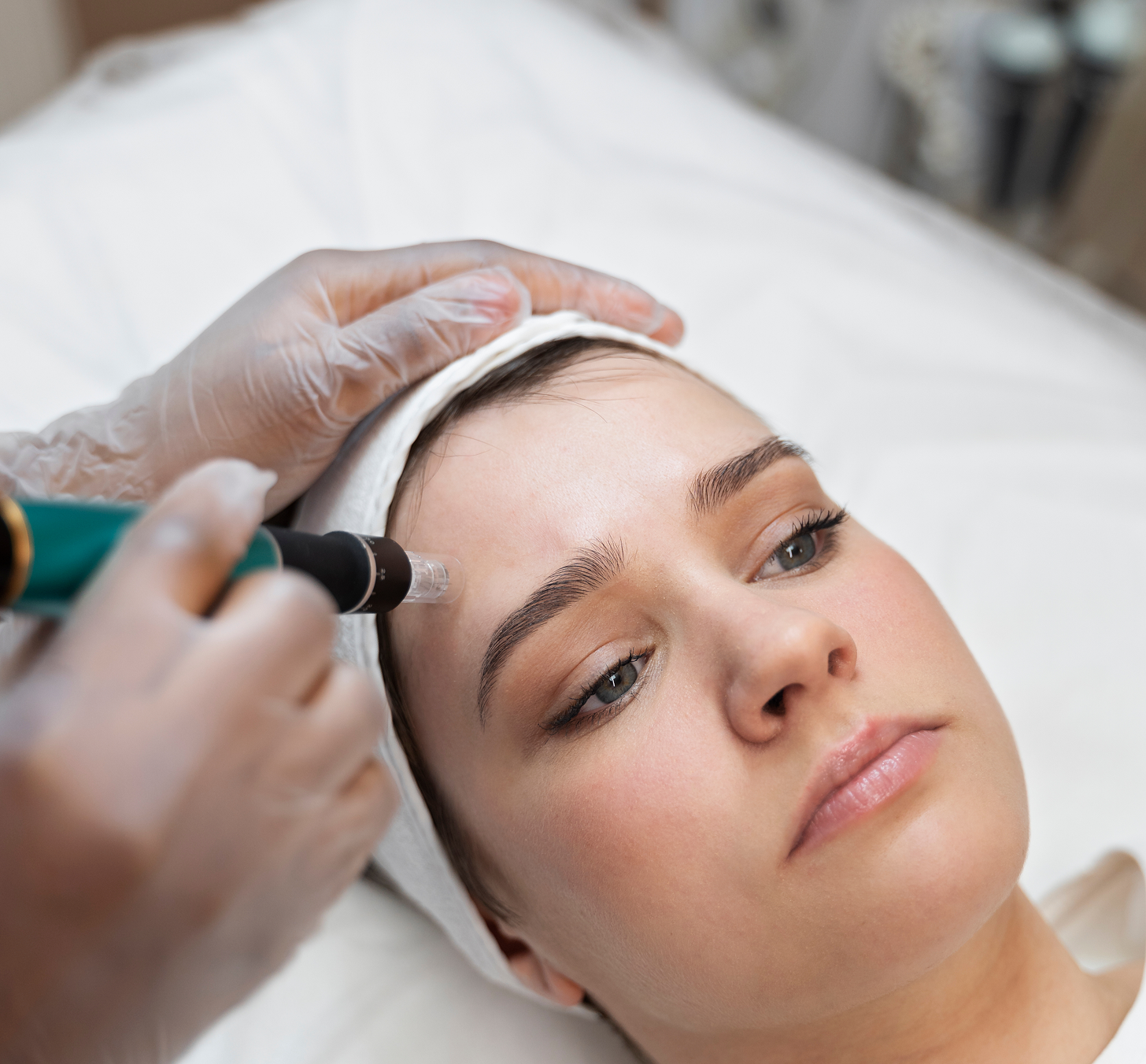 Microneedling