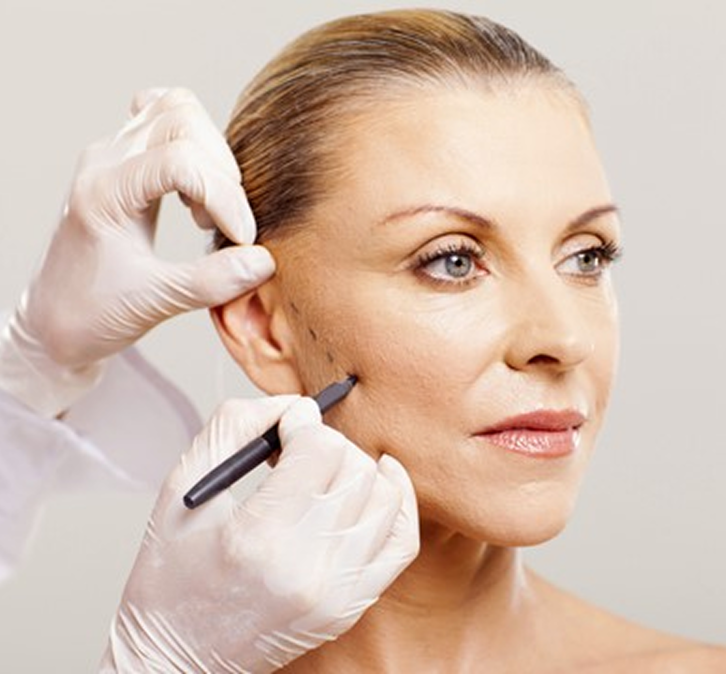 Botox / Fillers / Threads
